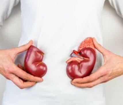 Prevalensi Gagal Ginjal Masih Tinggi, Sejauh Mana Transplantasi Ginjal Bisa Jadi Solusi?